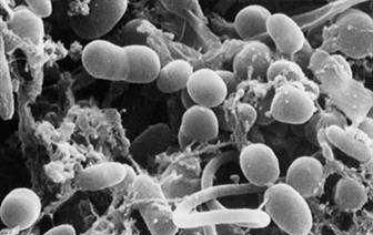 尽管病毒和细菌更引人注目，真菌却是地球上最大的杀手