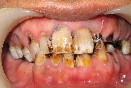 你知道人为什么只能换两次牙齿？