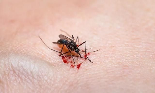 每年超70万人死亡！蚊子包越大，毒性越大？学会这几招让它退！退！退