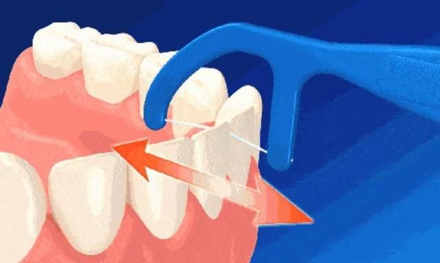 牙医力荐？实测四款水牙线，告诉你谁是清洁之王！